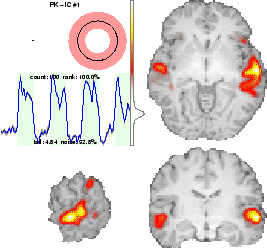 \includegraphics[width=0.48\textwidth]{images/results_primaryauditory.eps}