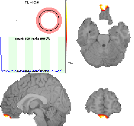 \includegraphics[width=0.48\textwidth]{images/results_scanninganomaly.eps}