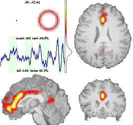 \includegraphics[width=0.48\textwidth]{images/results_cingulate.eps}