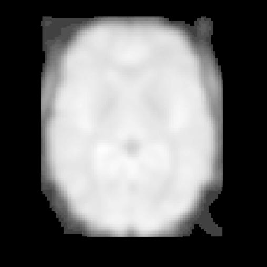 \includegraphics[height=6.5cm]{images/fmri_smooth.eps}